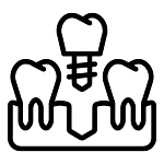 Dental Implant at Klinik Pergigian Aleph Dental Kota Kinabalu